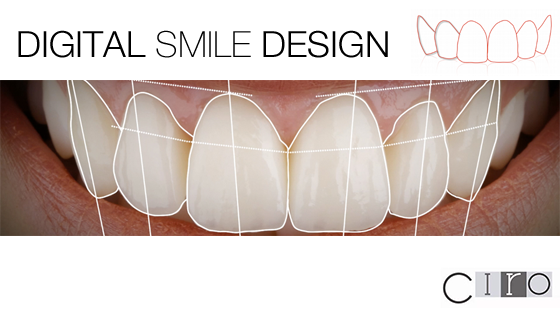 Diseñamos tu sonrisa ideal