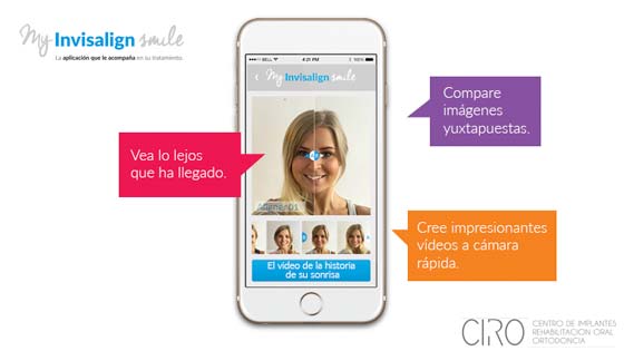 Aplicación móvil para pacientes de ortodoncia invisible