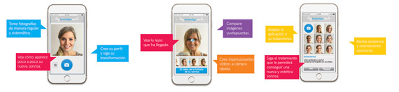 App Invisalign Ortodoncia transparente Madrid
