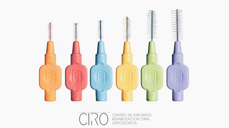 ¿Por qué es tan importante la limpieza interdental?