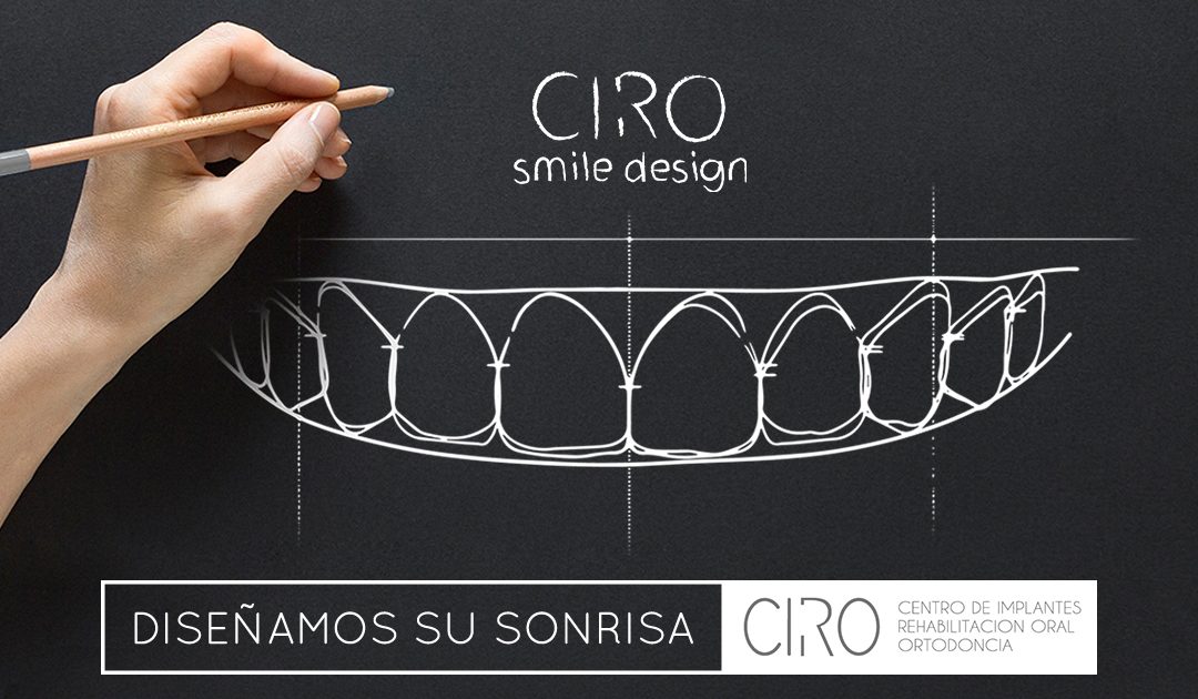 Diseño digital de sonrisa (DSD) en la Clínica CIRO: procedimiento