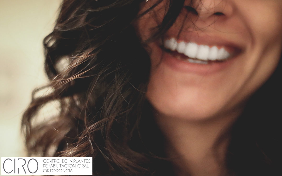 Ortodoncia estética: Alternativas y ventajas