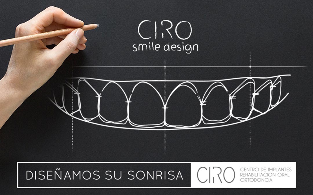 ¿Qué es el Diseño Digital de la Sonrisa?