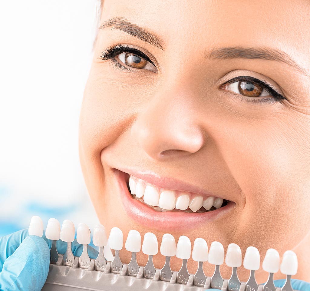 Claves por que elegir a la Clinica Ciro para llevar a cabo un tratamiento de blanqueamiento dental en Madrid