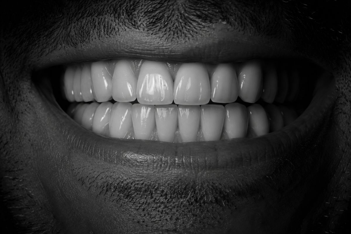 Rehabilitación oral completa para recuperar estética, función y sonrisa en Clínica CIRO Madrid