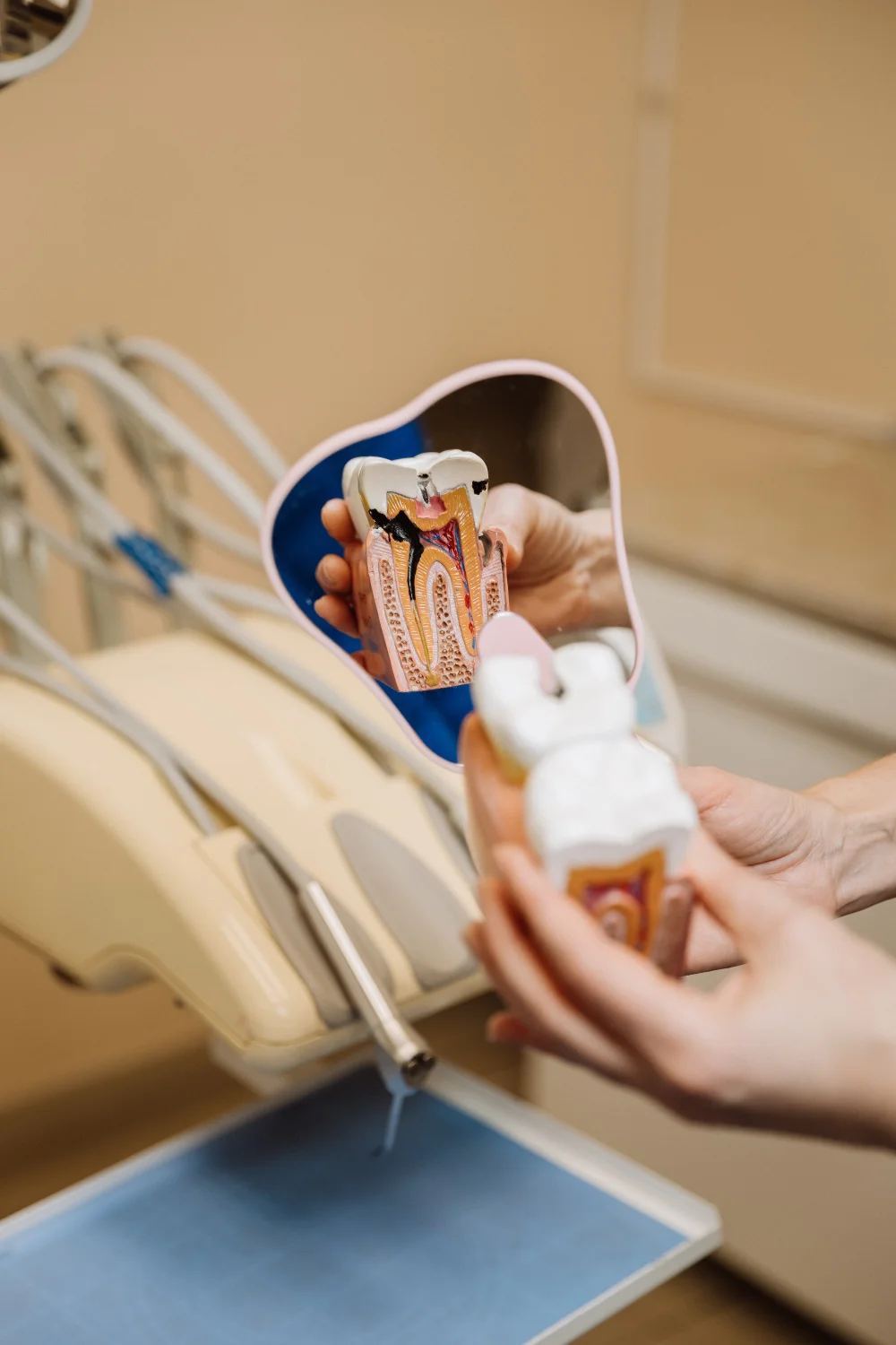 Endodoncia en Madrid CIRO