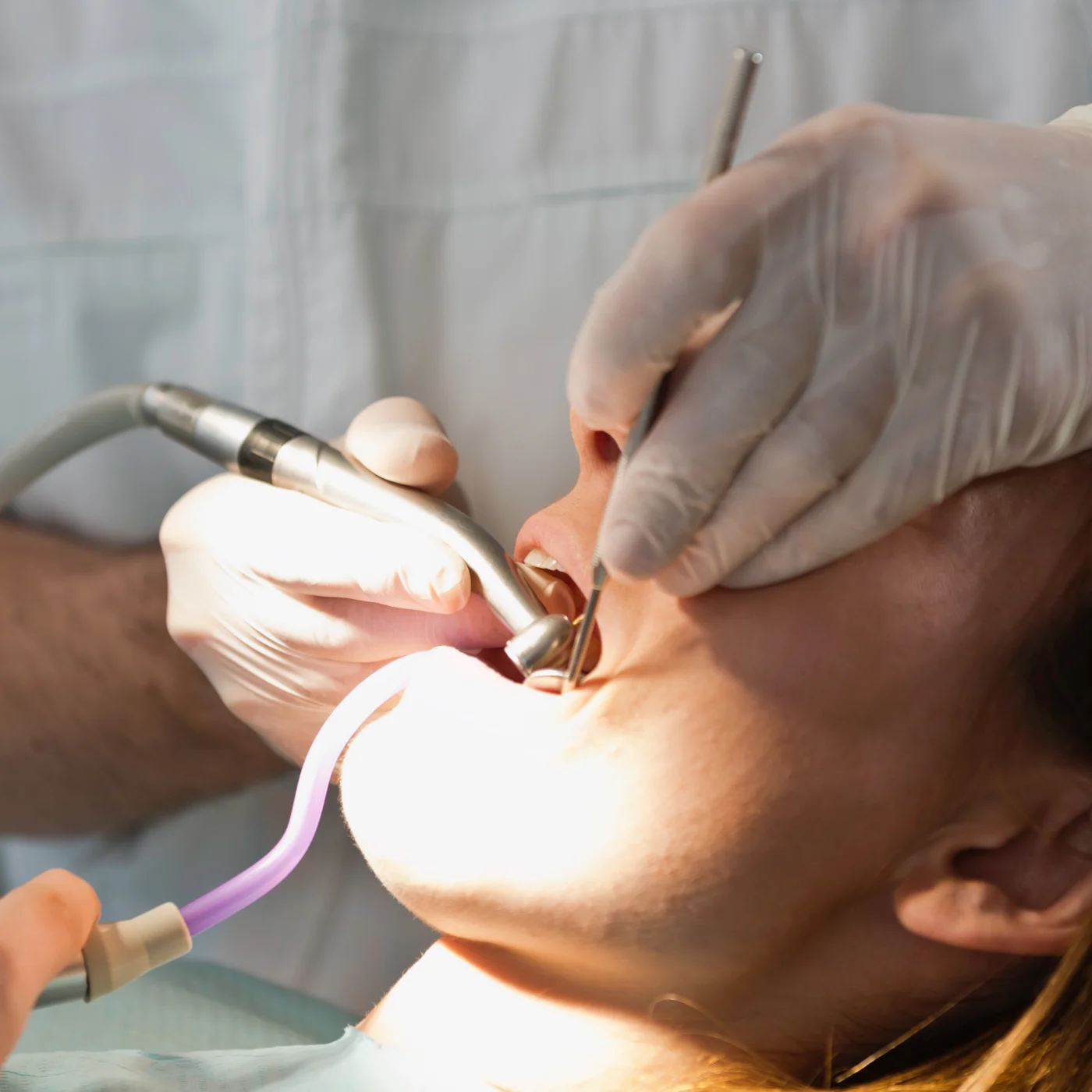 Endodoncia en Madrid - Clínica CIRO